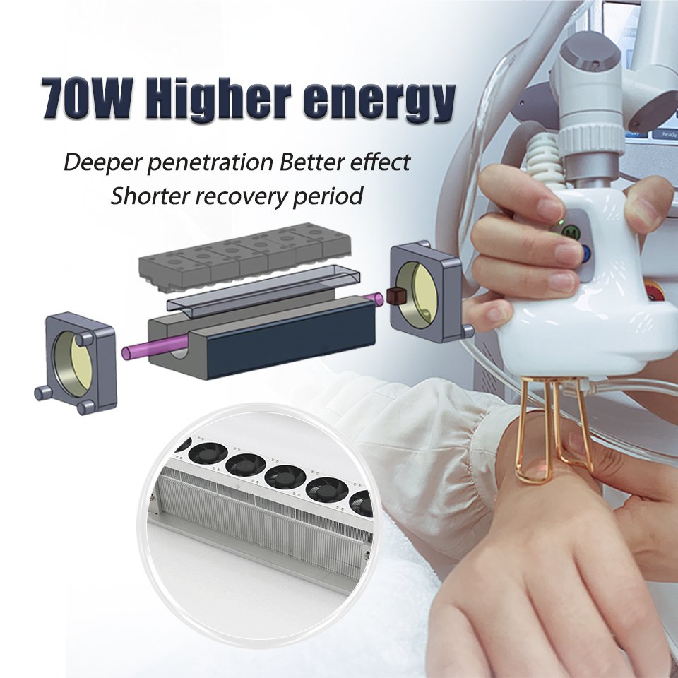 Winkonlaser 10600Nm Co2 Laser Rf Fractional Laser Acne Treatment Scar Removal Skin Resurfacing Vaginal Tightening For Clinic