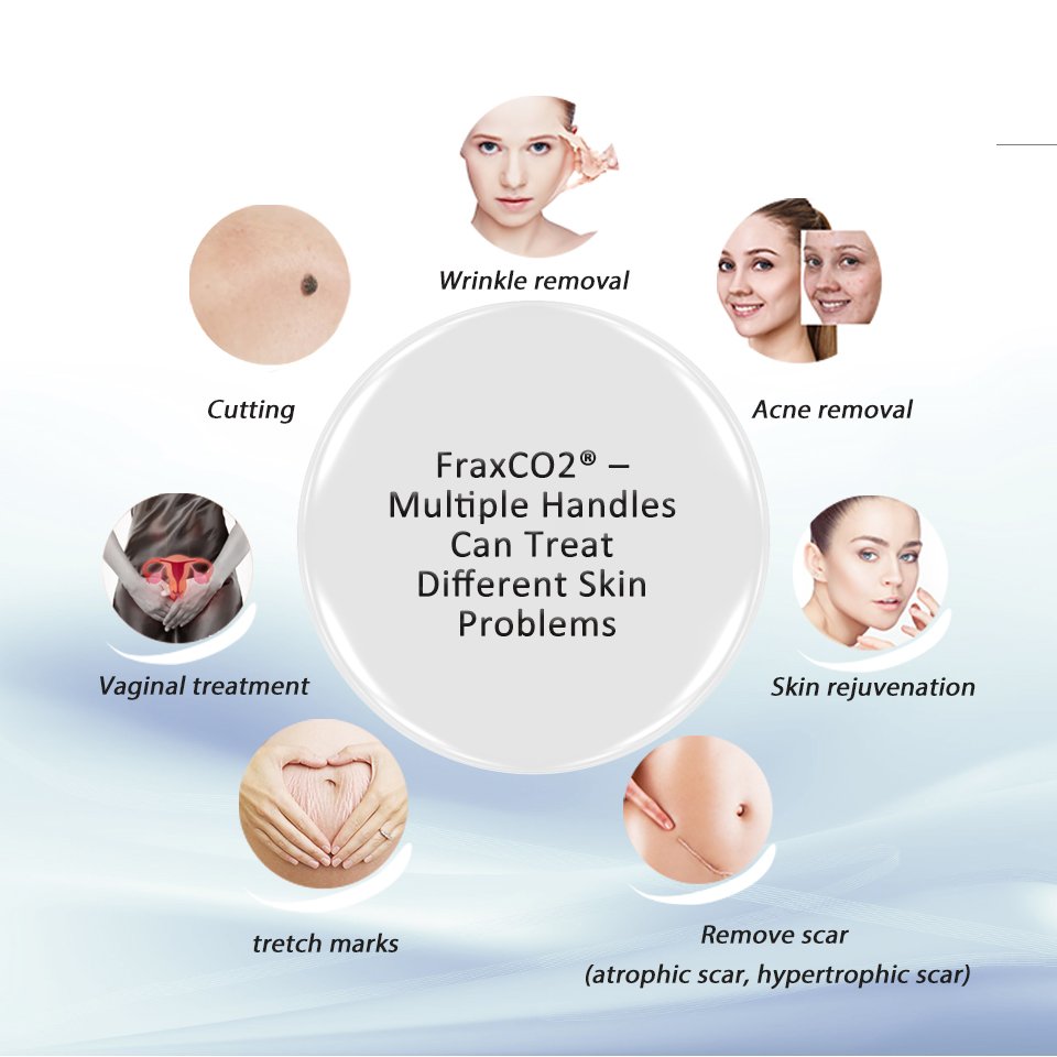 Winkonlaser 10600Nm Co2 Laser Rf Fractional Laser Acne Treatment Scar Removal Skin Resurfacing Vaginal Tightening For Clinic