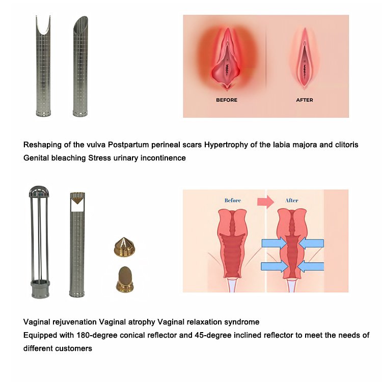 Winkonlaser 10600Nm Co2 Laser Rf Fractional Laser Acne Treatment Scar Removal Skin Resurfacing Vaginal Tightening For Clinic