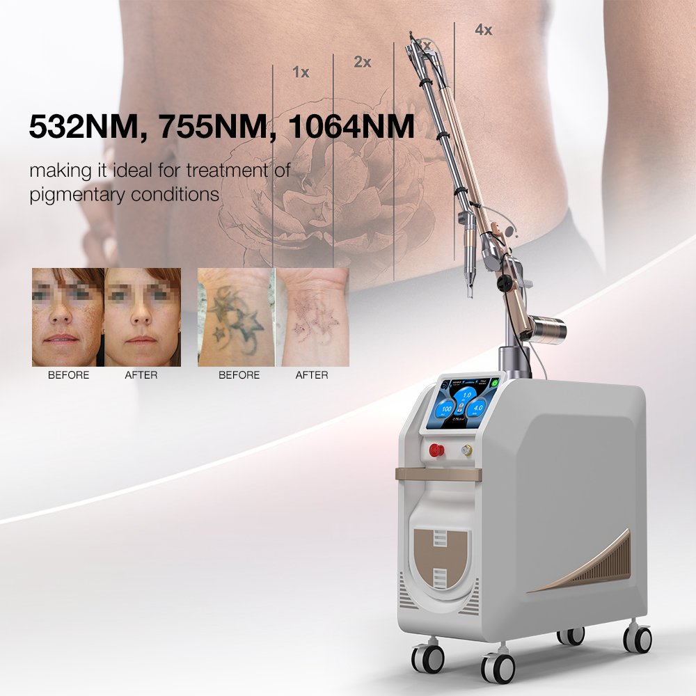 Winkonlaser Professional Pico Q-Switched Nd Yag Laser 1064Nm 532Nm Pico Carbon Peeling Tattoo Removal Machine