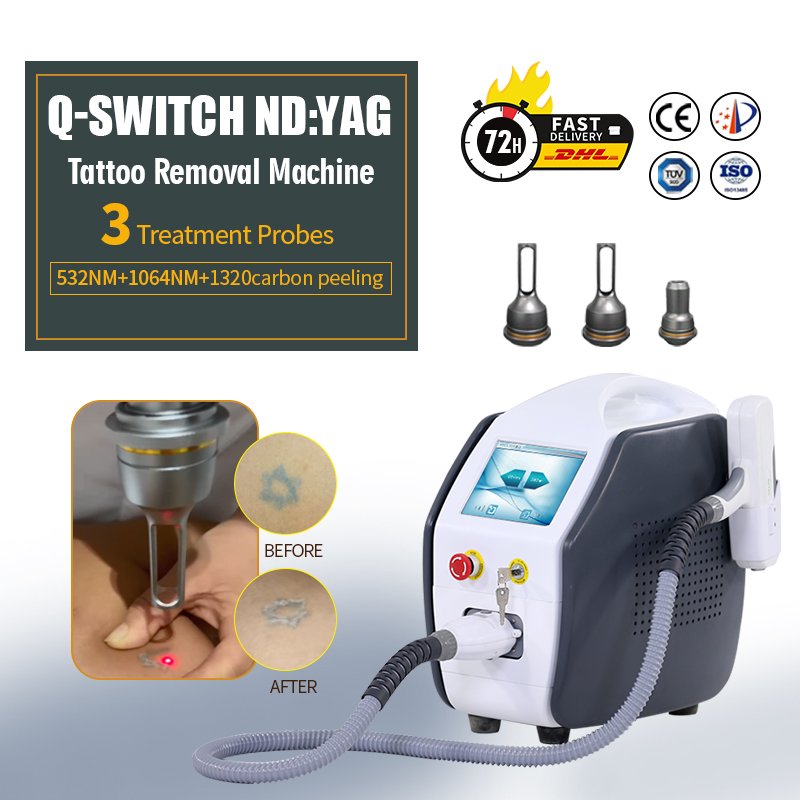 q switched nd yag laser machine 5 in 1 pigmentation removal