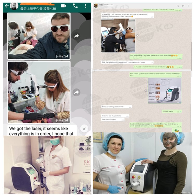 ndyag q-switch laser tattoo removal laser tattoo removal machine laser hair removal and tattoo machine