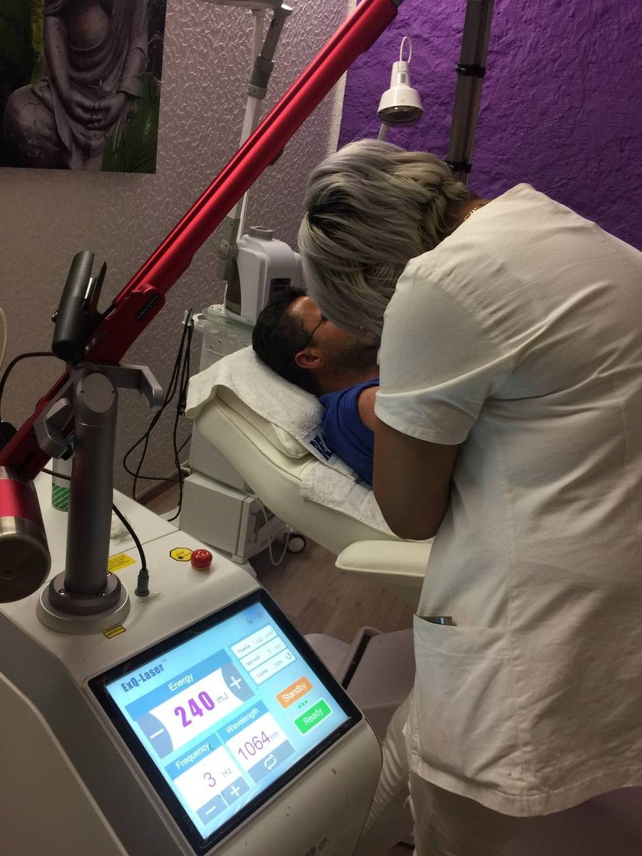 Alexandrite Q-Switched Laser For Pigmentation Removal Tattoo Removal Peel Carbon Skin Whitening Machine
