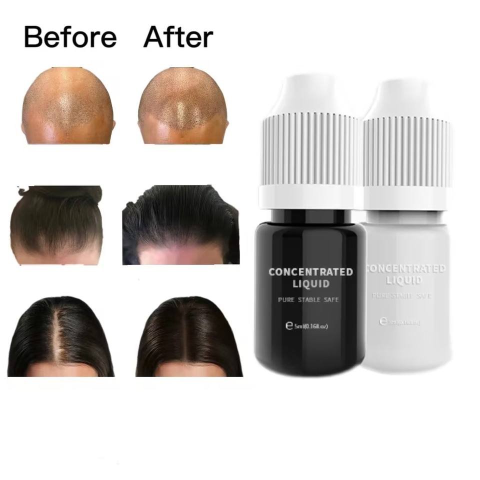 Factory price smp pigments follicle scalp micropigmentation products micro hair tattoo ink OEM microblading pmu organic pigment