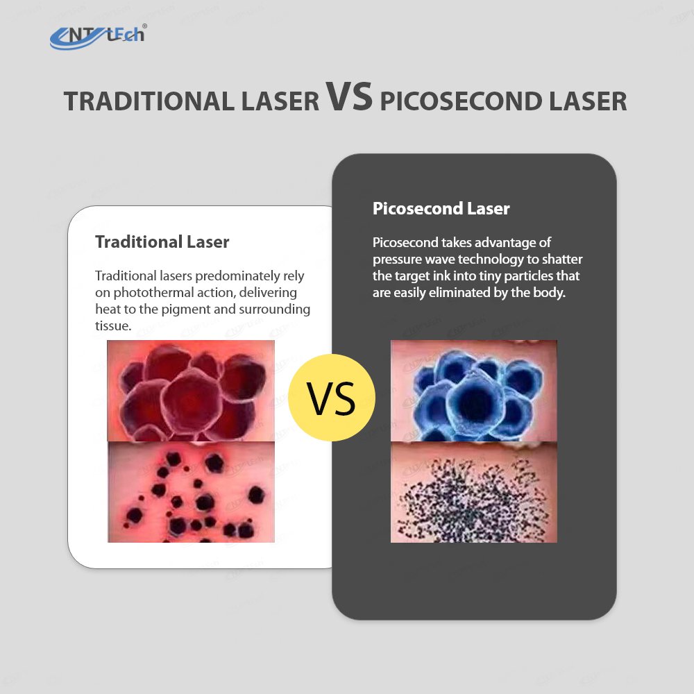 Discount 532nm 755nm 1064nm picosecond laser tattoo removal carbon q-switched pico laser with cooling