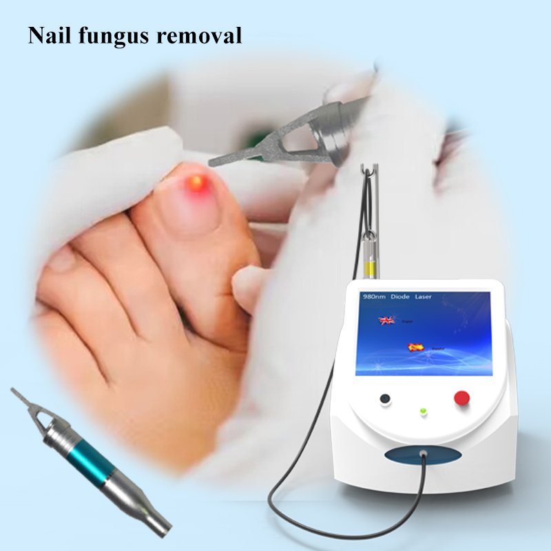 Podiatry diode laser device nail fungus treatment toenail laser podology machine for Onychomycosis
