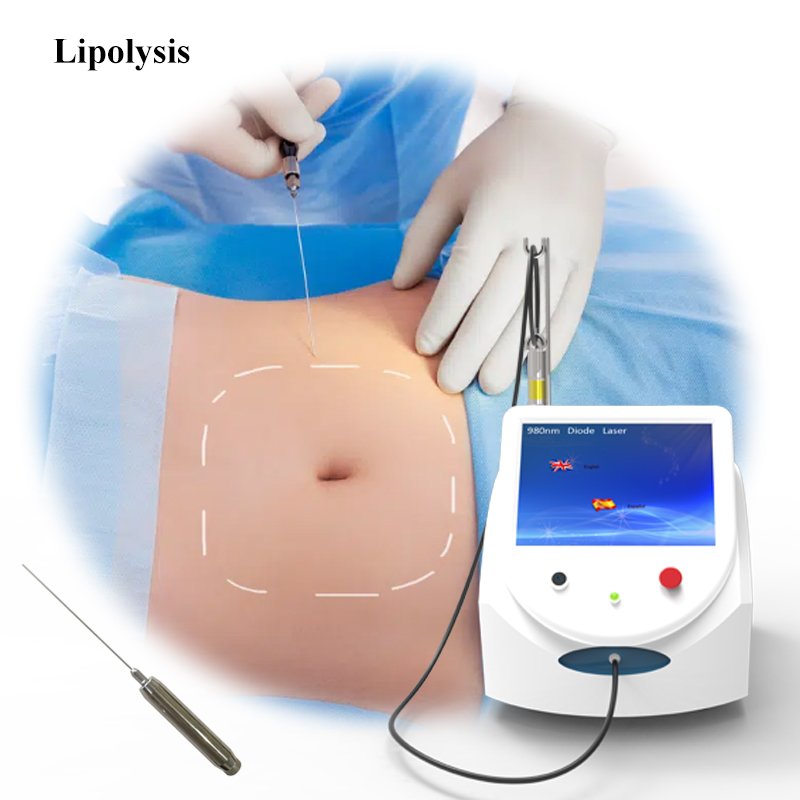 Podiatry diode laser device nail fungus treatment toenail laser podology machine for Onychomycosis