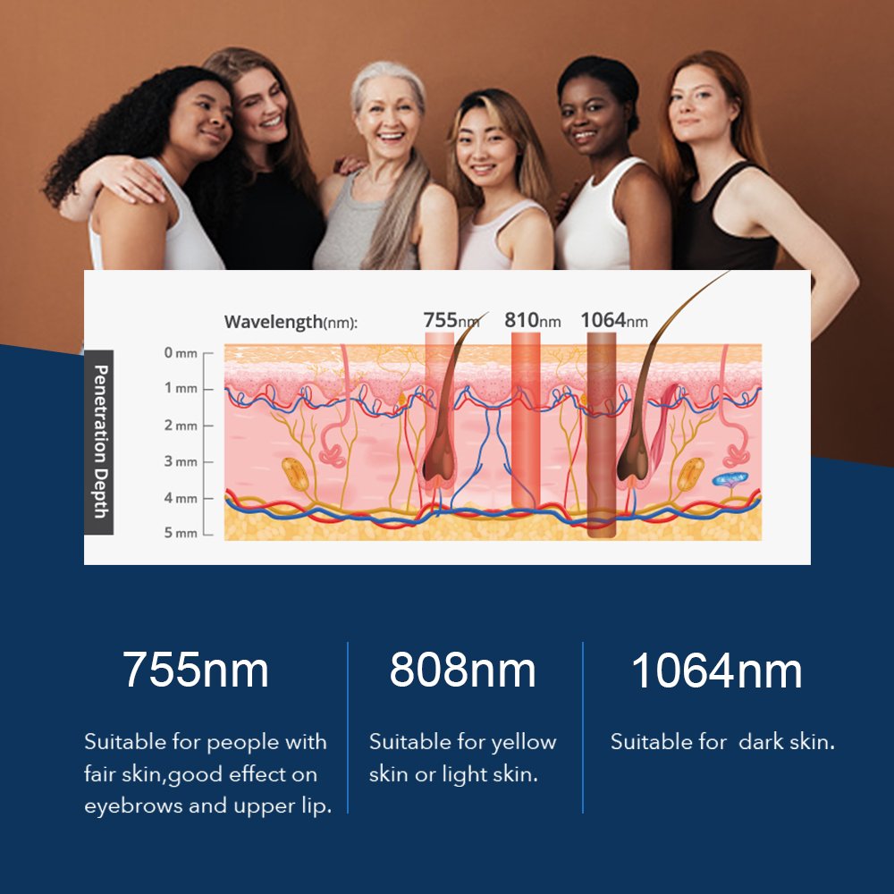 vertical stable lamis 810nm diode laser for hair removal 808nm beauty machine depilight triple wave 755 808 1064nm big spot size