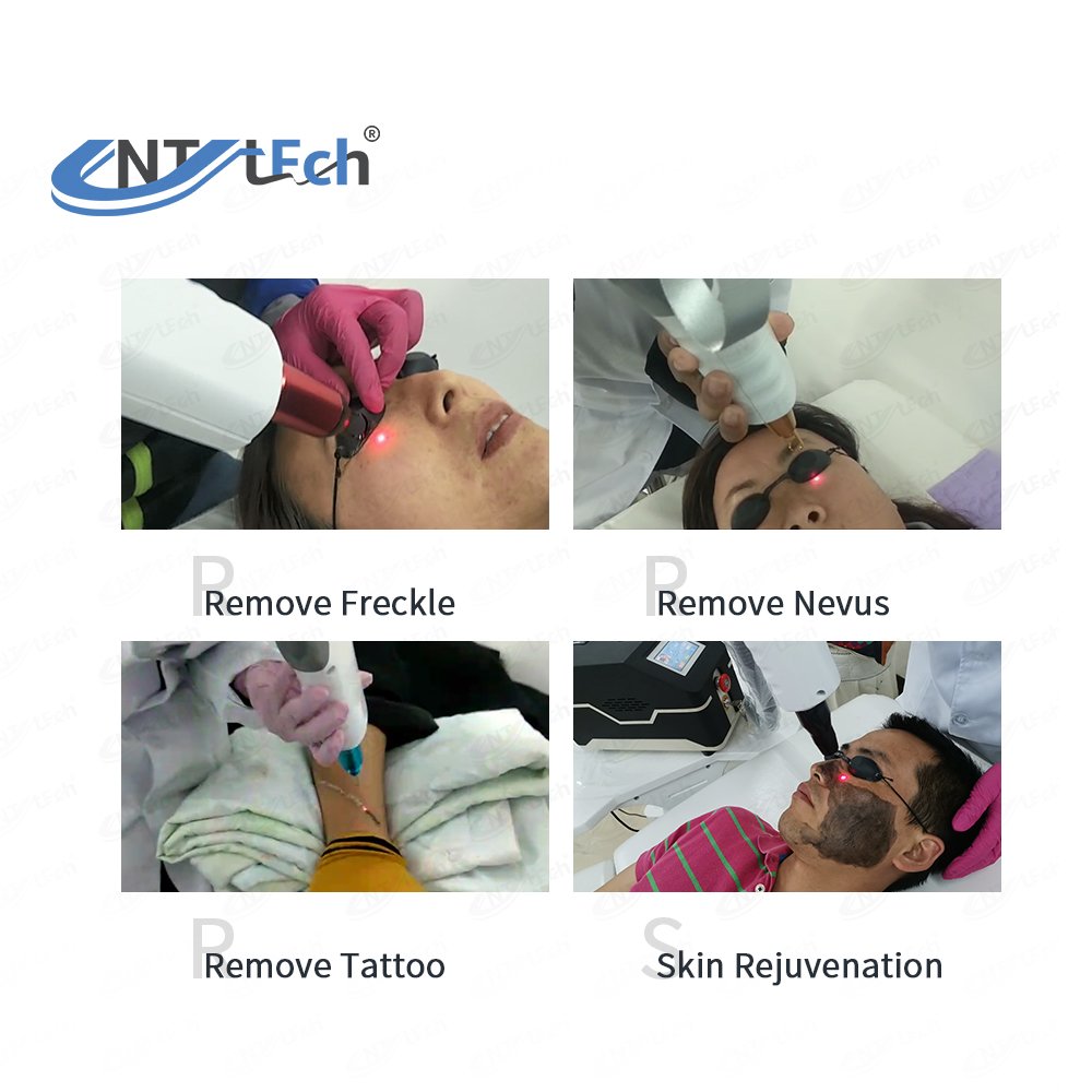 Nd yag laser machine spare parts for maintenance
