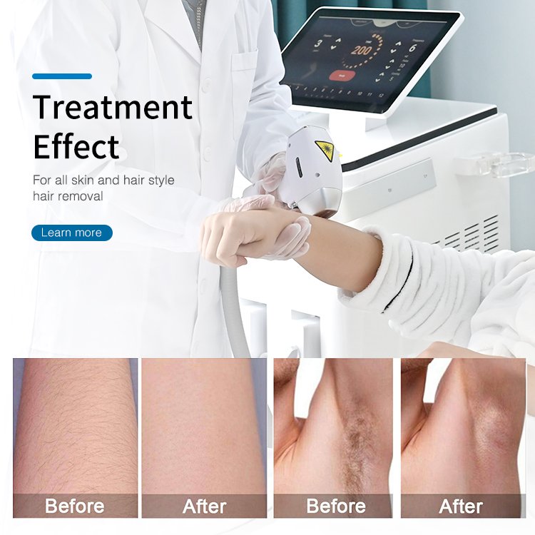 2024 newest best selling 2 In 1 Nd Yag Laser 3 Waves 755 808 1064 Nm Diode Laser Hair Removal Handle Tattoo Freckles Remove