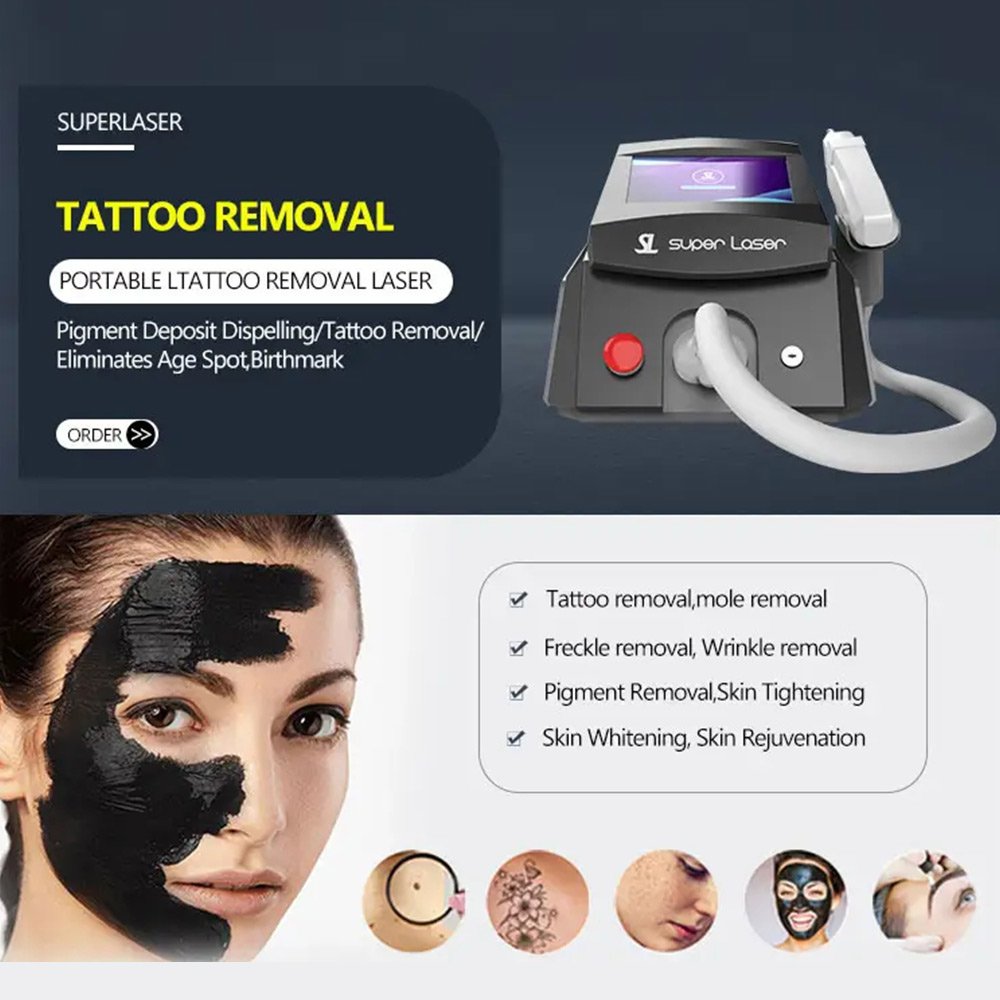 Ce Approved Q-switch Nd Yag Laser Tattoo Removal Machine With Big Power laser facial toning machine Skin Rejuvenation