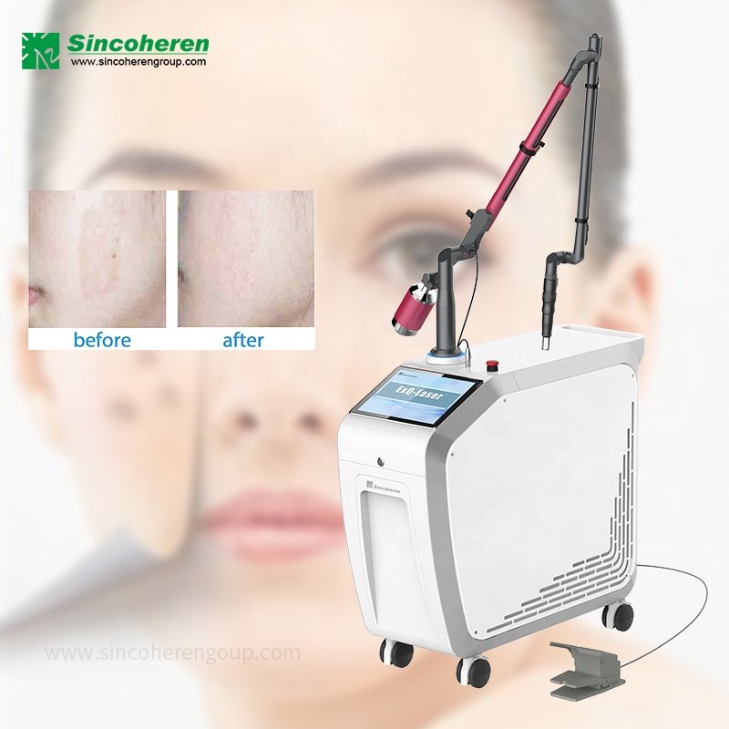 Sincoheren Q-switched ND yag laser machine professional tattoo removal picosecond laser machine for sale