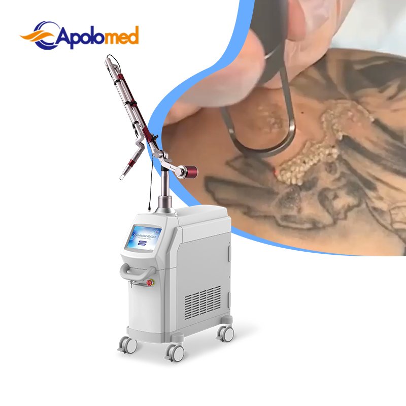 China Made Nd Yag Laser Nd Yag Laser Q Switch Nd Yag Q Switched Laser