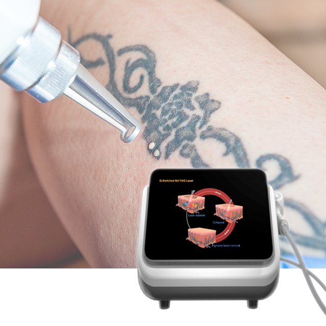 2024 New Factory Supply Q Switched Laser Machine 532/1064 dual Wavelength Portable Laser Tattoo Removal Machine