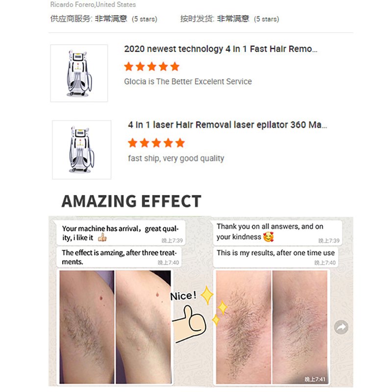Skin Rejuvenation Machine Ipl Laser Ipl Elight Hair Removal Machine Ipl Skin Rejuvenation
