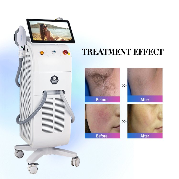 Painless Hot New Model Multi Function Dual Heads Ice Laser Diode Laser Hair Removal Machine Price Stationary No No Hair Removal