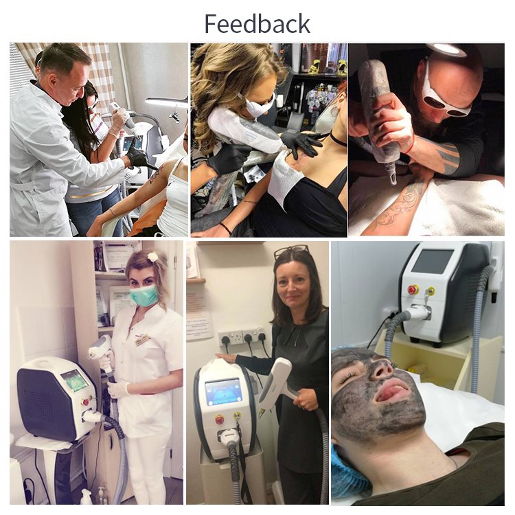 professional portable mini nd yag laser tattoo removal machine hair removal device