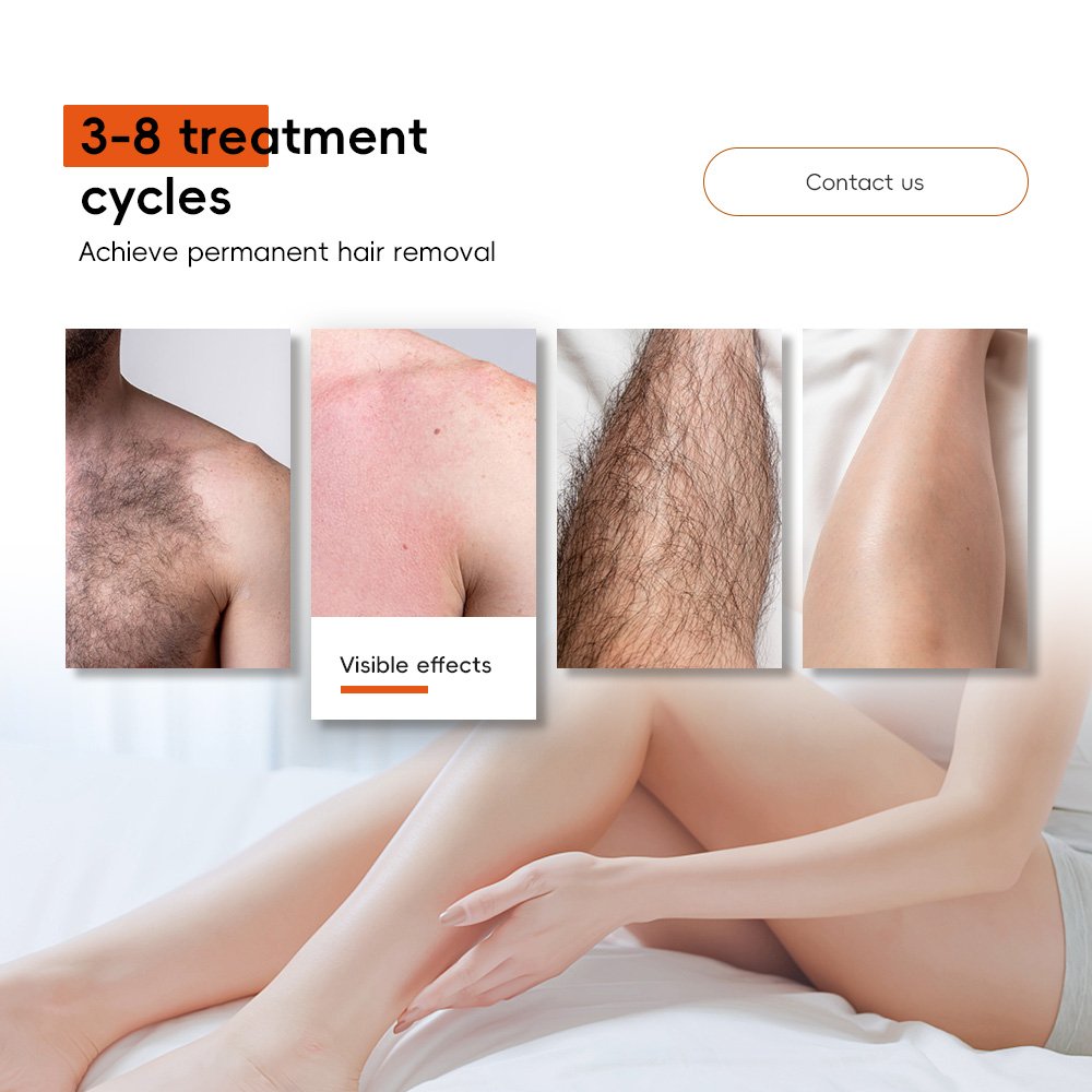 2024 Newest Arrival Ice Titanium Diode Laser Beauty Equipment 755/808/1064nm Permanent Hair Removal Epilator