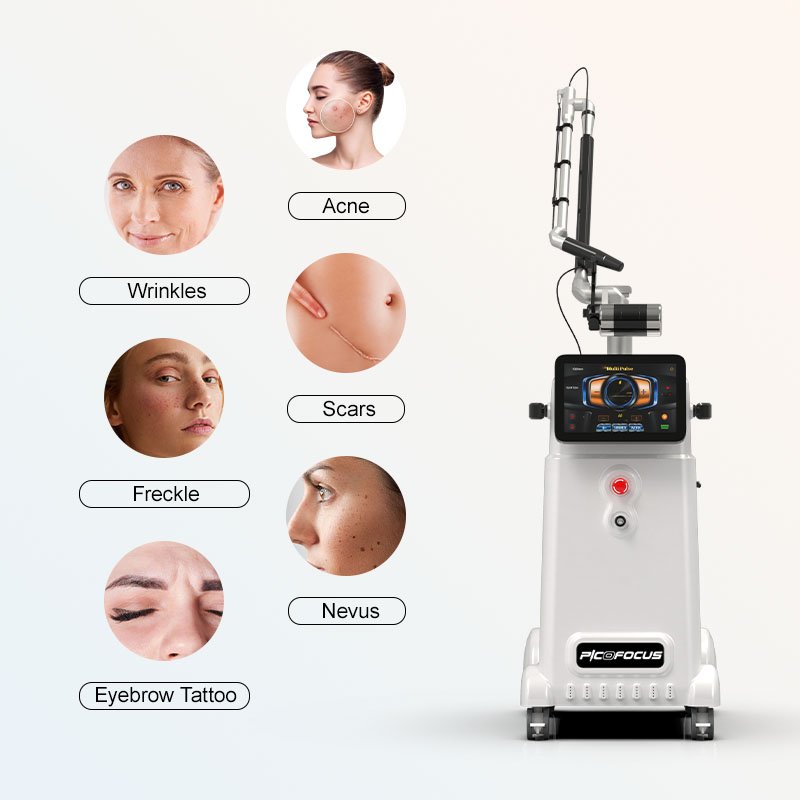 1064Nm 532Nm Second Skin Age Spots Picosecond Tattoo Removal Revlite Q Switched Nd Yag Laser