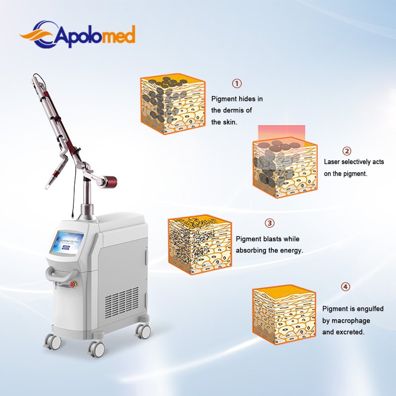 Apolomed Medical CE Q Switch pico laser Tattoo Remover ND YAG Laser Device