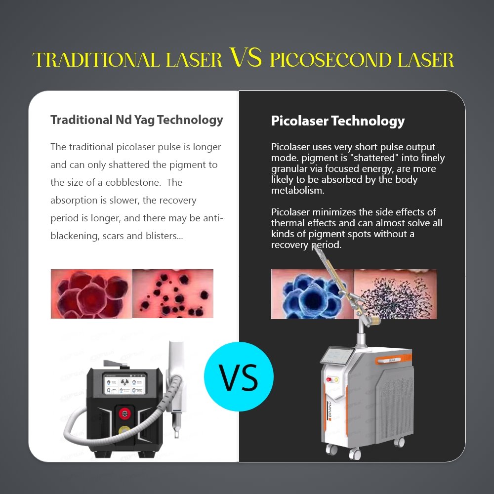Multifunctional pico laser tattoo removal picosecond laser machine