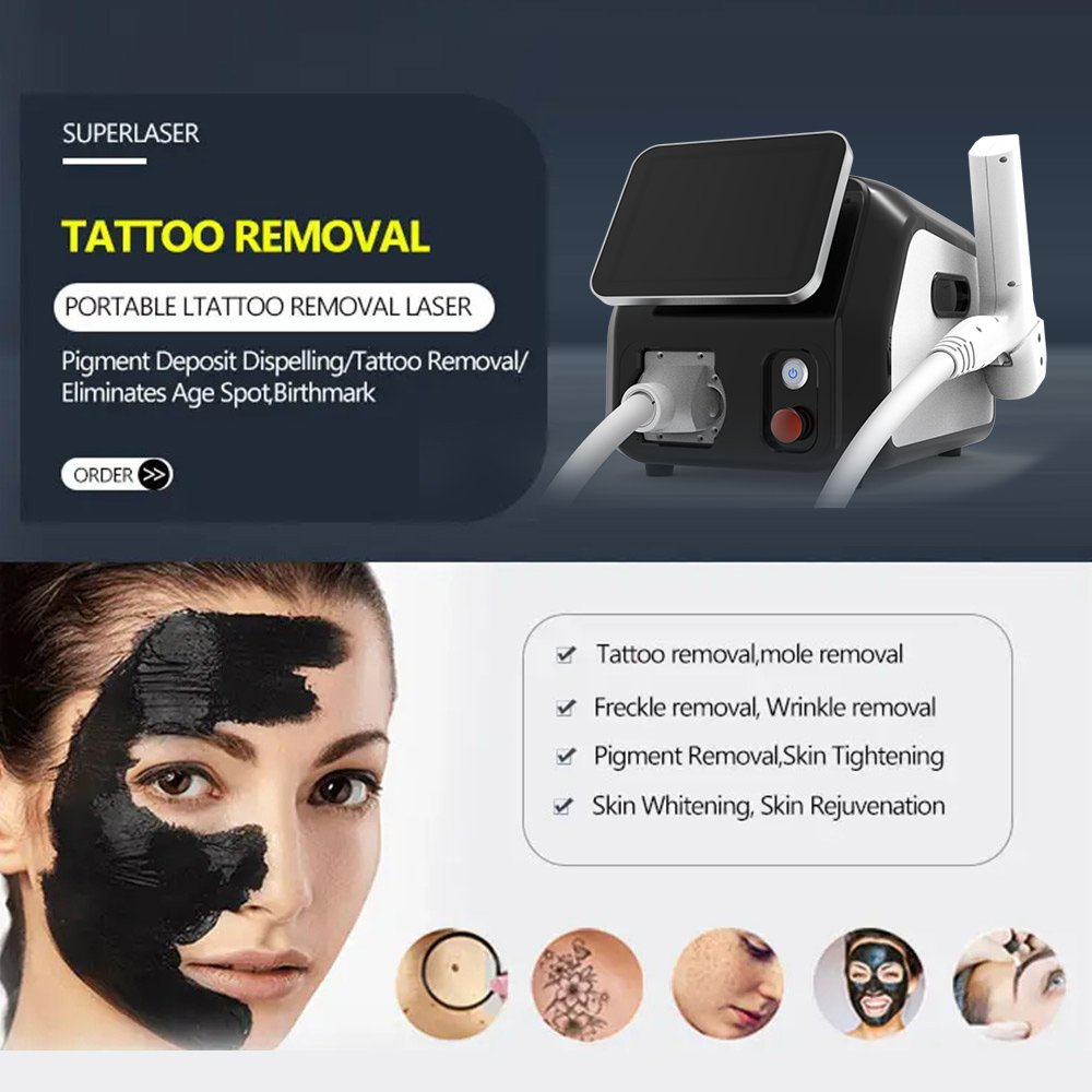 Portable Q-Switch nd Yag Laser 532/1064nm picosecond laser Black Carbon peeling Facial Portable pigment Tattoo Removal Machine