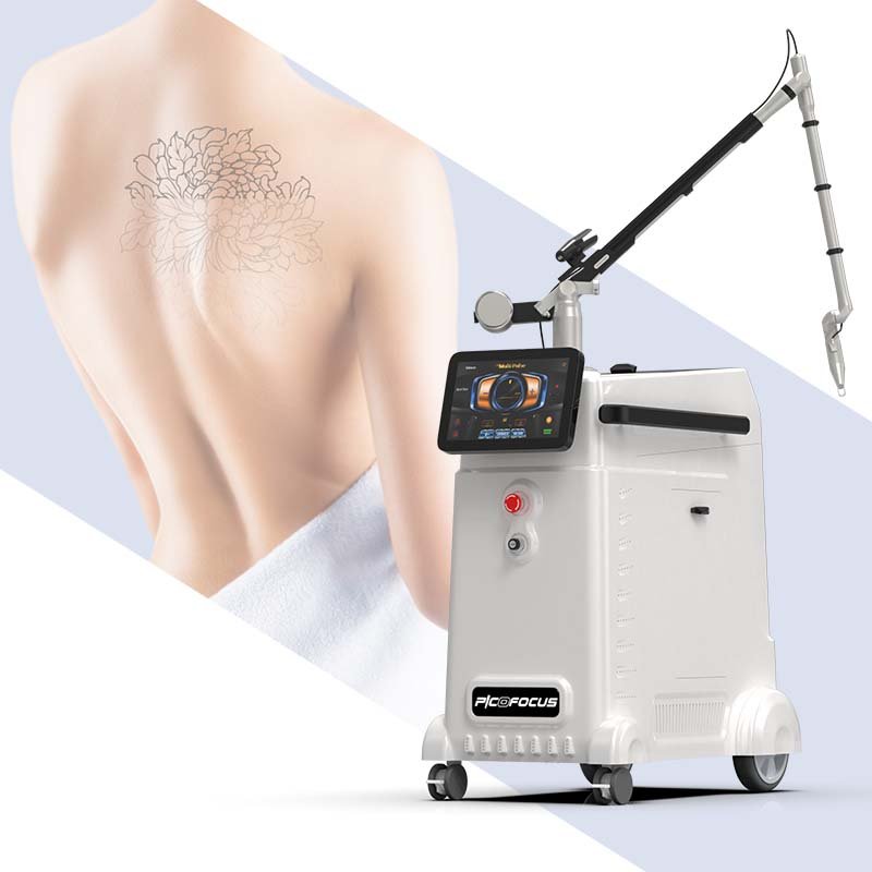 Second Skin Picosecond Tattoo Removal Revlite Q Switched Nd Yag Laser Pigment Treatment Device For Age Spots