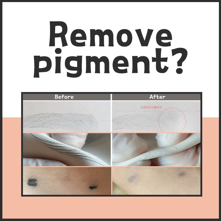 Permanent Makeup Pigment Private Label Color Remover Pigment Ink Eraser Dr Drawing Pigment Eraser Ink Remover
