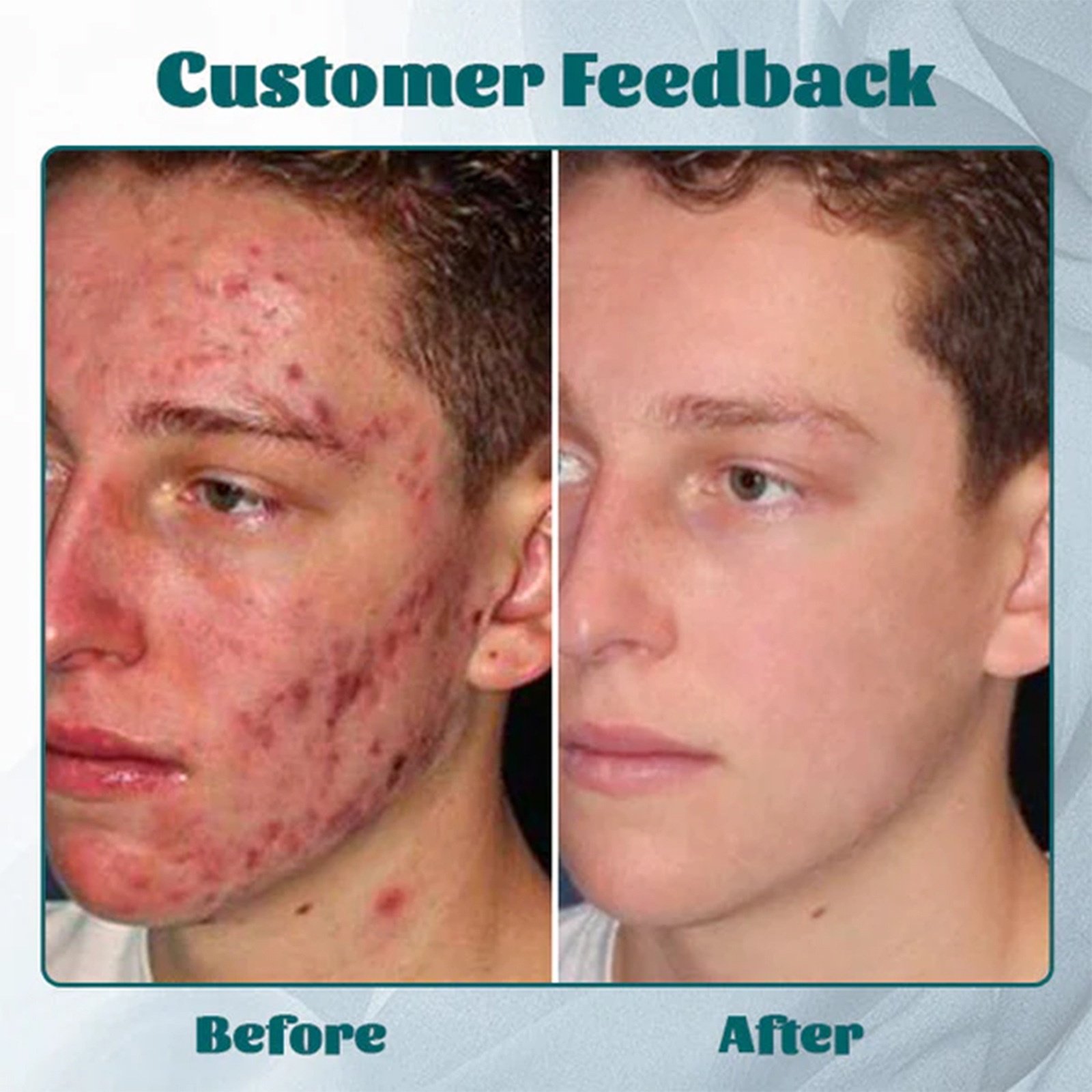 Factory Men's Multi-Benefit Facial Cream Smooths Fine Lines, Lightens Acne Scars, Hydrates & Moisturizes for Anti-Aging Results