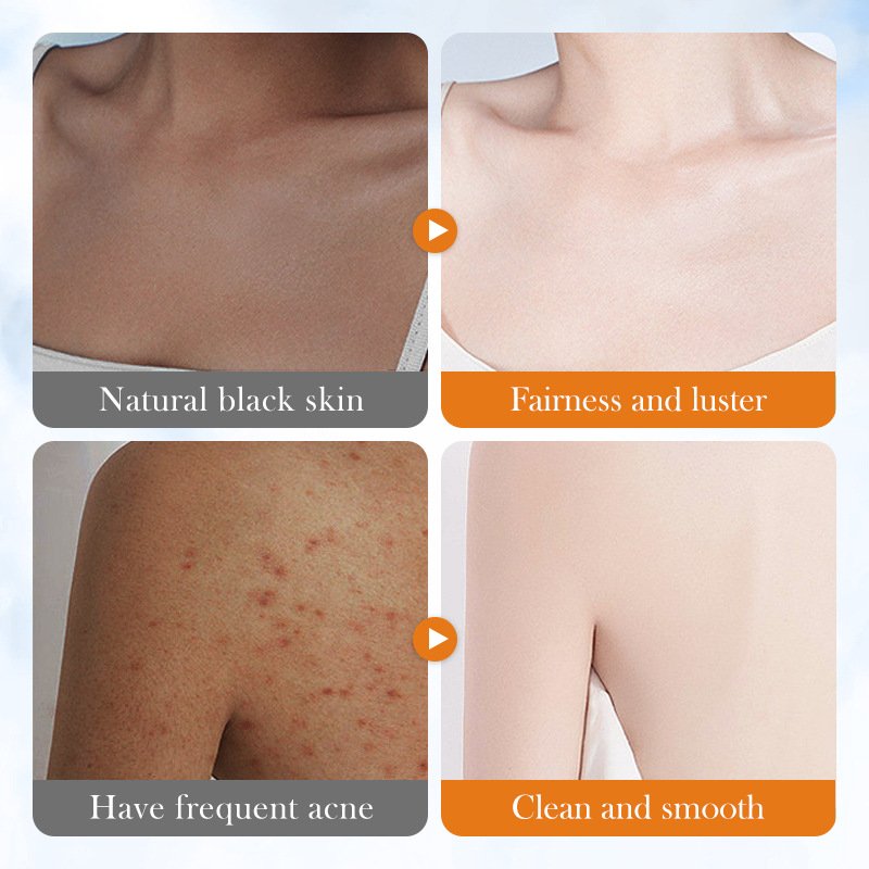 260ml Private Label Brightening Skin Volcanic Mud Body Wash Bleach Whitening Shower Gel