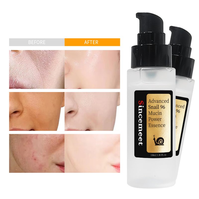 Snail Mucin 96% Power Repairing Essence 3.38 Fl.oz,100ml,Hydrating Serum For Face With Snail Secretion Filtrate