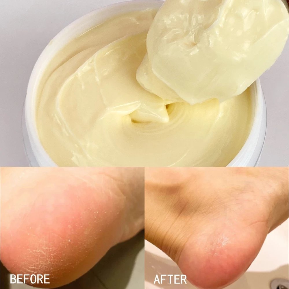AILKE Private Label Organic Shea Butter Body Cream 24-Hour Whitening and Moisturizing Lotion 100g Vegan Ingredients