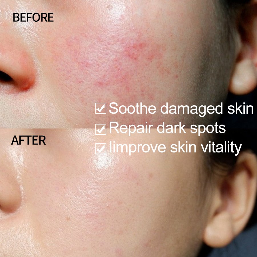 Herbicos bulk Advanced Snail 96 Mucin Power Essence OEM skincare manufacturer Face Anti Aging Whitening Snail serum