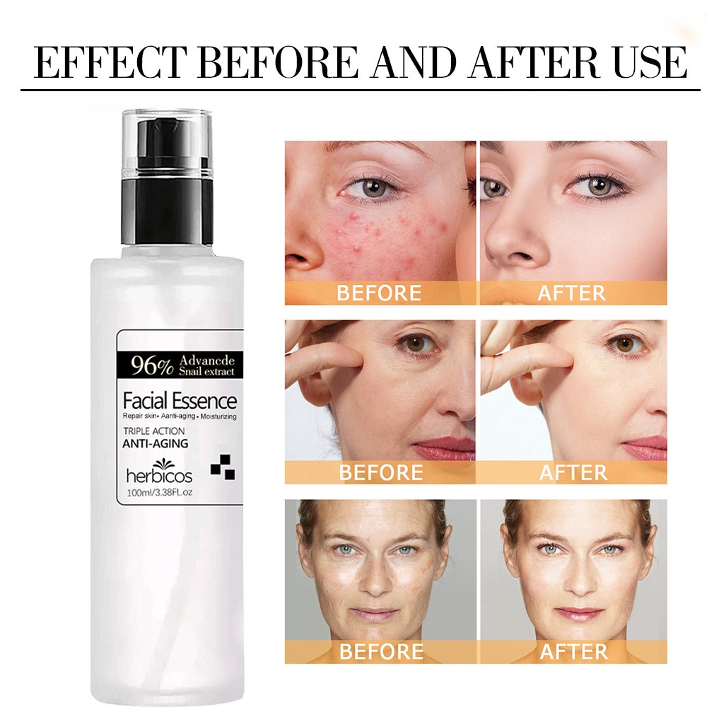 Herbicos bulk Advanced Snail 96 Mucin Power Essence OEM skincare manufacturer Face Anti Aging Whitening Snail serum