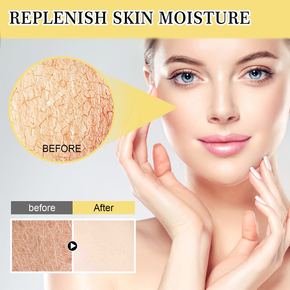 Herbicos Factory Price Advanced Snail 92 96 Mucin Power Essence 100ml Face Anti-Aging Skin Care Snail Essence