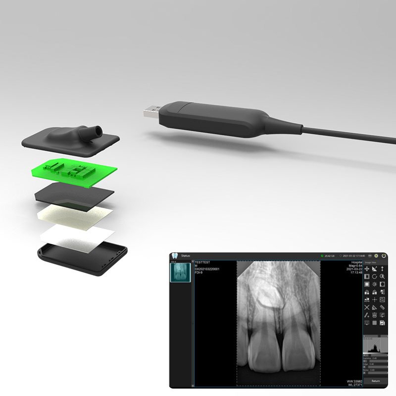 Hot selling High frequency portable dental X-ray unit,digital xray sensor xray,Oral X-ray machine, clear, low radiation handheld