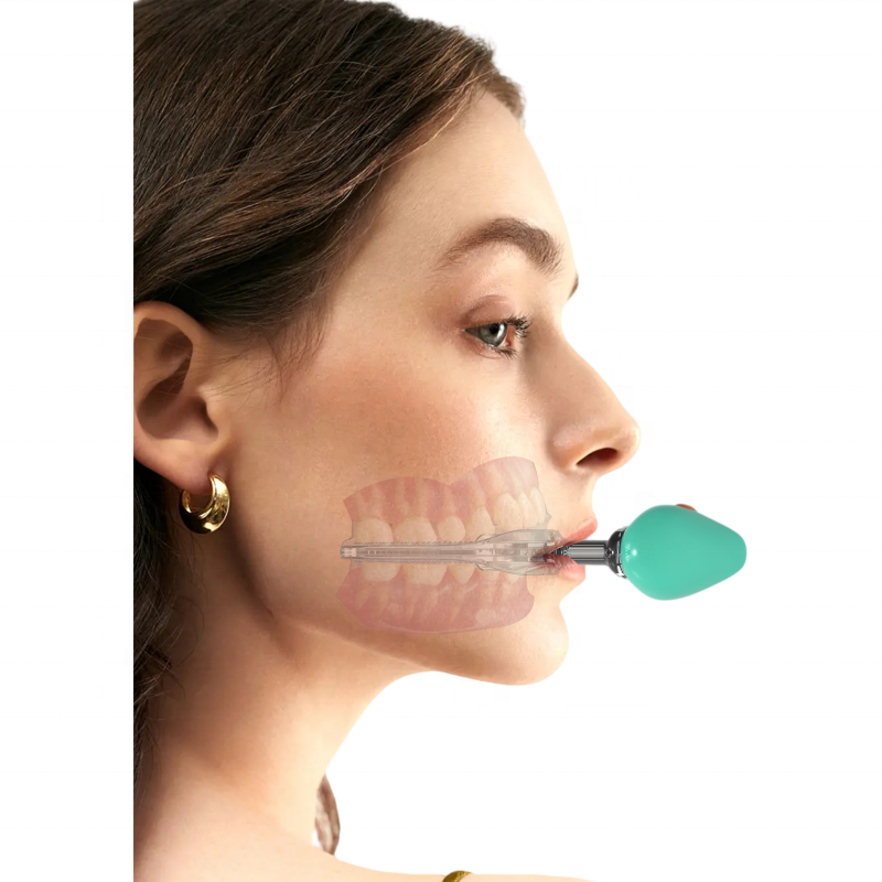Recommend The Use Of Fast Straightening Dental Accelerator Vibration Orthodontic Tooth Support Device For Sales Dentistry
