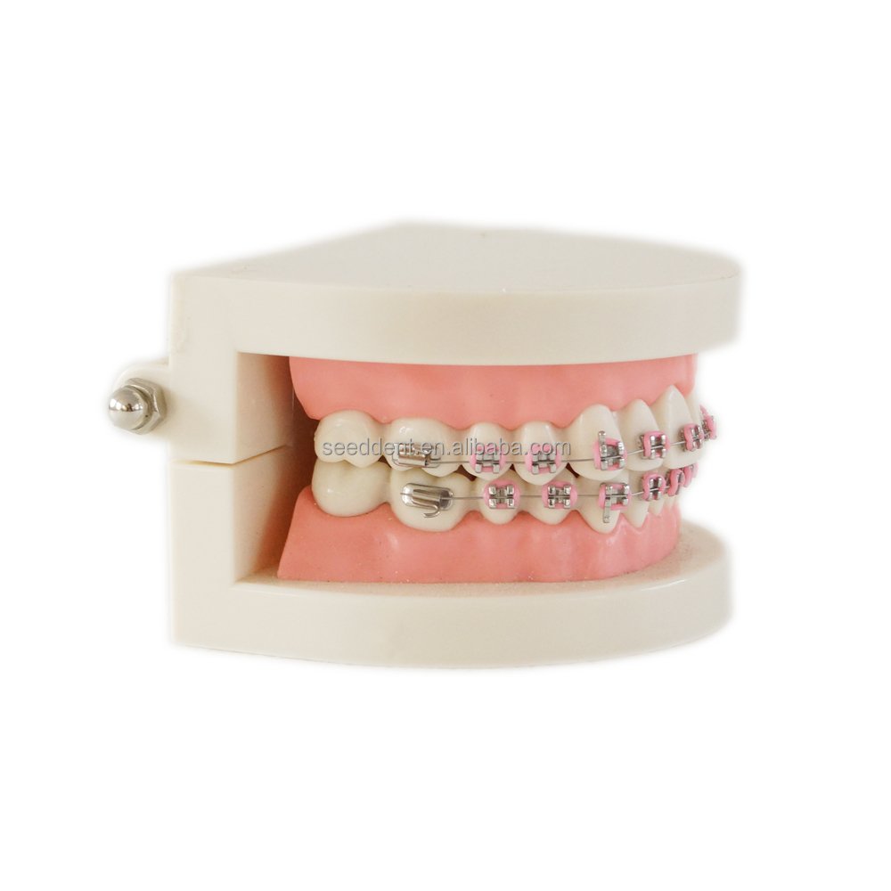 Dental Orthodontic Treatment Model With Ortho Metal Ceramic Bracket / 28pcs Orthodontic dental teeth model