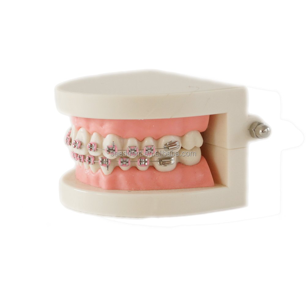 Dental Orthodontic Treatment Model With Ortho Metal Ceramic Bracket / 28pcs Orthodontic dental teeth model