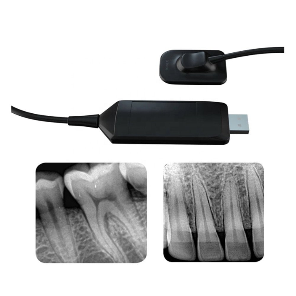 Dental Xray Sensor R1 Digital Multi Language Size 1 Intra-Oral Include Software USB RVG X-ray Medical Equipment