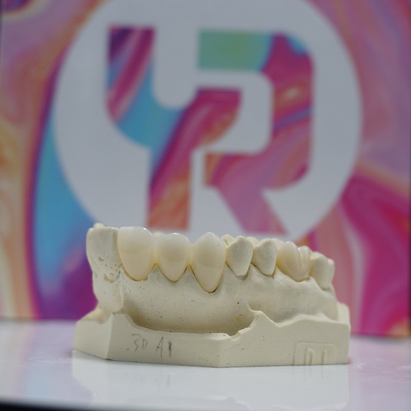 Yucera 4D Pro Multilayer Zirconia Block Open System Thickness 14/16/18mm 16 Colors for Dental Lab CadCam milling material