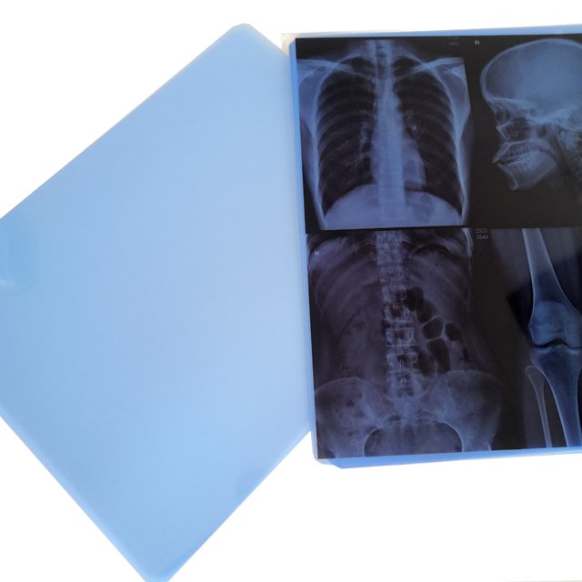 Elantra self-revealing dental medical x-ray green film positioner 30 x 40 price