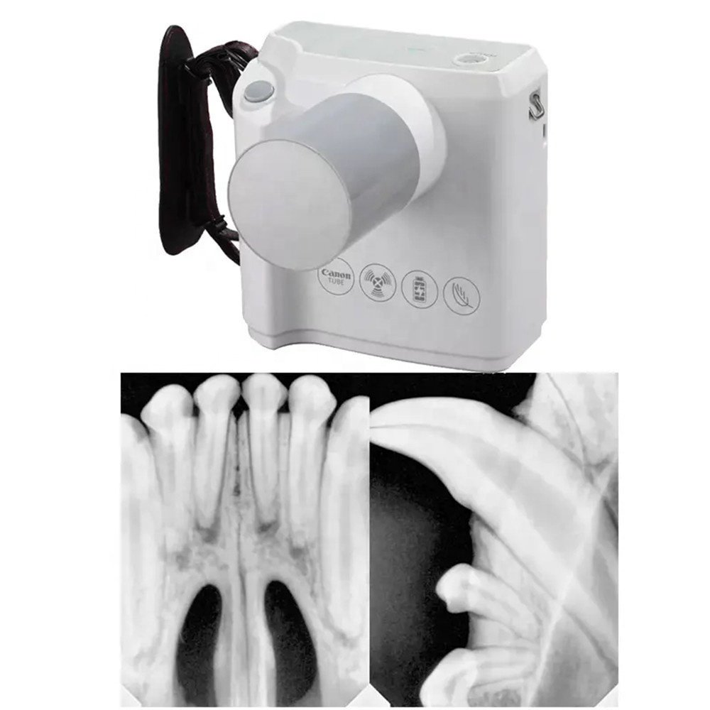 70KV 2mA Portable Dental X-Ray Machine Digital X Ray Unit Factory Price