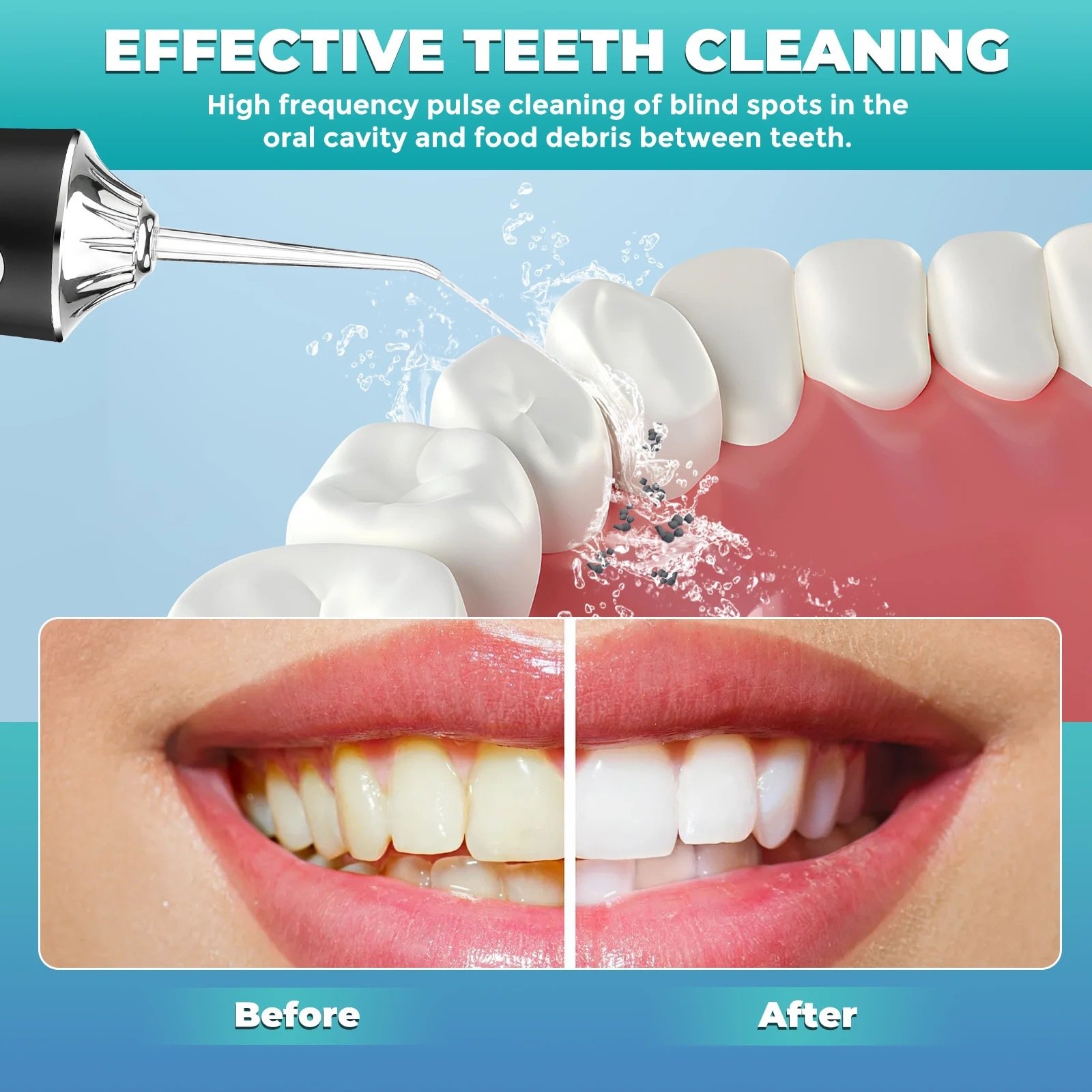 Wholesale Electric Waterproof Rechargeable Dental Jet Cordless Care Professional Teeth Cleaning Oral Irrigator Water Flosser