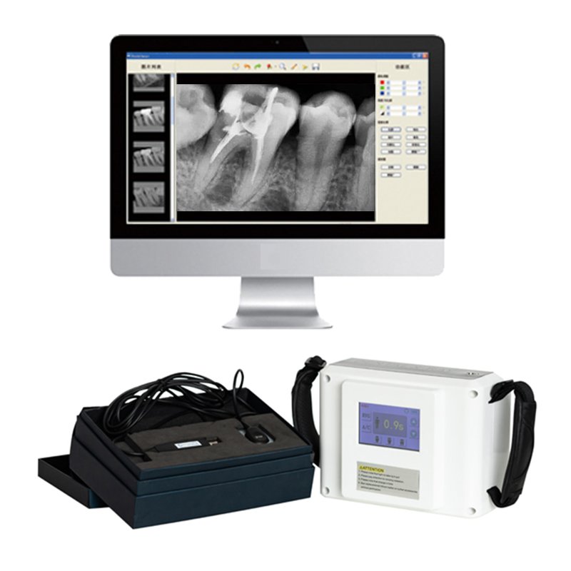 Dental Equipment Sensor X-ray Machine Digital Portable Dental X Ray Machine