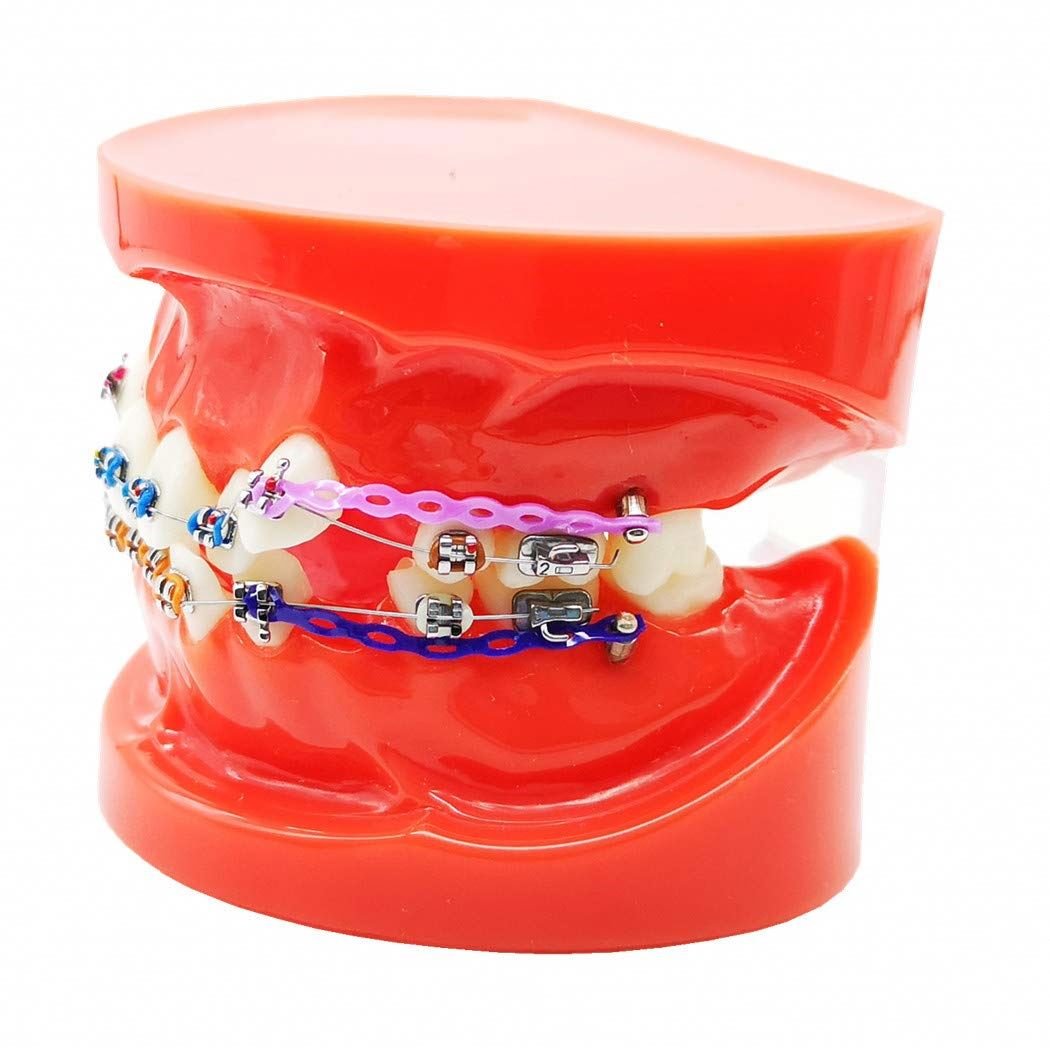 Dental Orthodontic Treatment Model With Ortho Metal Ceramic Bracket / 28pcs Orthodontic dental teeth model