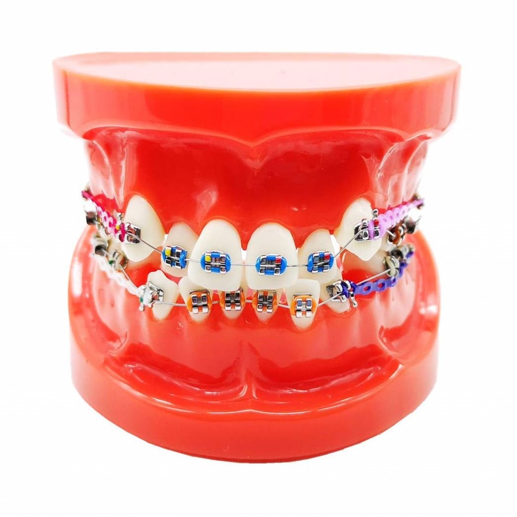 Dental Orthodontic Treatment Model With Ortho Metal Ceramic Bracket / 28pcs Orthodontic dental teeth model