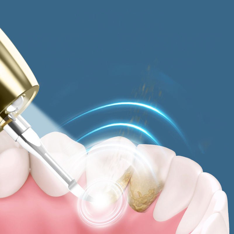 Ultrasonic Oral Care Appliances Teeth Cleaning Tools Visible Plaque Tartar Remover with Led Light Other Dental Equipment