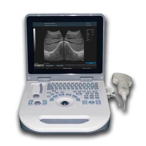 Mindray Vet Ultrasound Portable veterinary Ultrasound machine price
