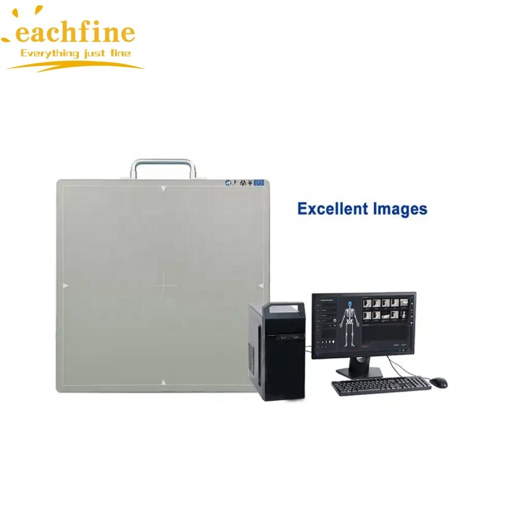 Wholesale Price Veterinary Xray 14 * 17 Inch Wireless Flat Panel DR Detector X Ray Wireless DR Digital X-ray Flat Detector Panel